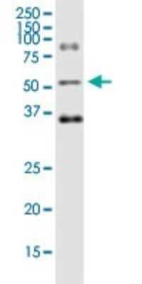 Western Blot: Ornithine Decarboxylase Antibody (2G5) [H00004953-M01] - ODC1 monoclonal antibody (M01), clone 2G5. Analysis of ODC1 expression in A-431.