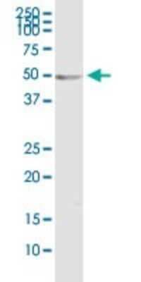 Western Blot: Ornithine Decarboxylase Antibody (2G5) [H00004953-M01] - ODC1 monoclonal antibody (M01), clone 2G5. Analysis of ODC1 expression in rat brain.