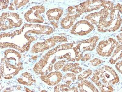 Immunohistochemistry-Paraffin: Ornithine Decarboxylase Antibody (ODC1/2878R) [NBP3-07470] - Formalin-fixed, paraffin-embedded human Prostate stained with Ornithine Decarboxylase Rabbit Recombinant Monoclonal Antibody (Ornithine Decarboxylase/2878R).