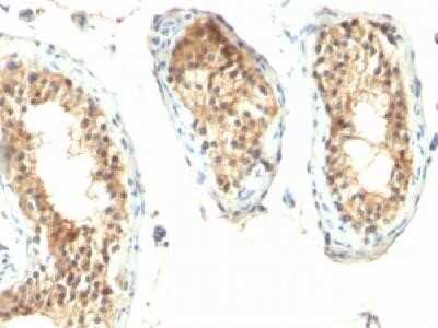 Immunohistochemistry-Paraffin: Ornithine Decarboxylase Antibody (ODC1/485) - IHC-Prediluted [NBP2-44732] - Formalin-fixed, paraffin-embedded human Testicular carcinoma with ODC-1 Monoclonal Antibody (ODC1/485)