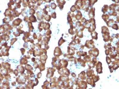 Immunohistochemistry-Paraffin: Ornithine Decarboxylase Antibody (ODC1/487) - IHC-Prediluted [NBP2-48322] - Formalin-fixed, paraffin-embedded Rat Pancreas stained with ODC1 Monoclonal Antibody (ODC1/487)