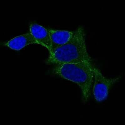 Immunocytochemistry/Immunofluorescence: Ornithine Decarboxylase Antibody (ODC1/487) [NBP2-44735] - IF staining of LNCap cells using AF488 labeled Ornithine Decarboxylase Antibody (ODC1/487). (Green). DAPI was used to stain the cell nuclei (blue).