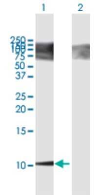 Western Blot: Osteocalcin Antibody [H00000632-B01P] - Analysis of BGLAP expression in transfected 293T cell line by BGLAP polyclonal antibody.  Lane 1: BGLAP transfected lysate(11 KDa). Lane 2: Non-transfected lysate.