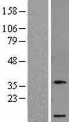 Western Blot: Osteocrin Overexpression Lysate (Adult Normal) [NBL1-14007] Left-Empty vector transfected control cell lysate (HEK293 cell lysate); Right -Over-expression Lysate for Osteocrin.