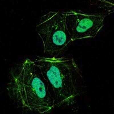 Immunocytochemistry/Immunofluorescence: Osteoprotegerin/TNFRSF11B Antibody (5G2) [NBP1-51670] - Immunofluorescence analysis of HL-60 cells using TNFRSF11B mouse mAb (green). Blue: DRAQ5 fluorescent DNA dye.