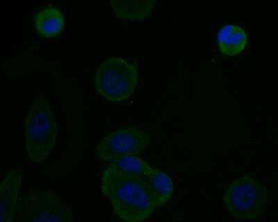 Immunocytochemistry/Immunofluorescence: Osteoprotegerin/TNFRSF11B Antibody (9C1) [NBP2-76903] - ICC staining Osteoproteger in MCF-7 cells (green). The nuclear counter stain is DAPI (blue). Cells were fixed in paraformaldehyde, permeabilised with 0.25% Triton X100/PBS.