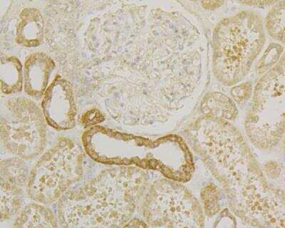 Immunohistochemistry: Osteoprotegerin/TNFRSF11B Antibody (9C1) [NBP2-76903] - Immunohistochemical analysis of paraffin-embedded human kidney tissue using anti-Osteoprotegerin antibody. Counter stained with hematoxylin.