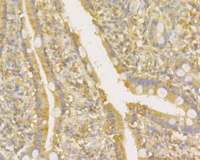 Immunohistochemistry: Osteoprotegerin/TNFRSF11B Antibody (9C1) [NBP2-76903] - Immunohistochemical analysis of paraffin-embedded human small intestine tissue using anti-Osteoprotegerin antibody. Counter stained with hematoxylin.
