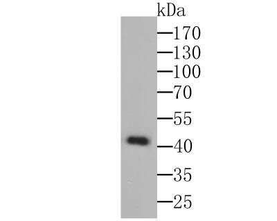 Western Blot: Osteoprotegerin/TNFRSF11B Antibody (9C1) [NBP2-76903] - Western blot analysis of Osteoprotegerin on K562 cell lysate using anti-Osteoprotegerin antibody at 1/1000 dilution.
