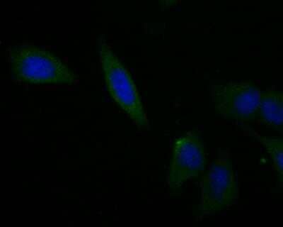 Immunocytochemistry/Immunofluorescence: Osteoprotegerin/TNFRSF11B Antibody (9C2) [NBP2-76904] - ICC staining Osteoproteger in MCF-7 cells (green). The nuclear counter stain is DAPI (blue). Cells were fixed in paraformaldehyde, permeabilised with 0.25% Triton X100/PBS.