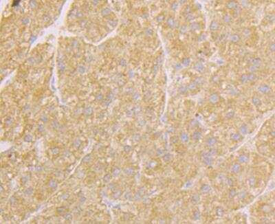 Immunohistochemistry: Osteoprotegerin/TNFRSF11B Antibody (9C2) [NBP2-76904] - Immunohistochemical analysis of paraffin-embedded human liver tissue using anti-Osteoprotegerin antibody. Counter stained with hematoxylin.