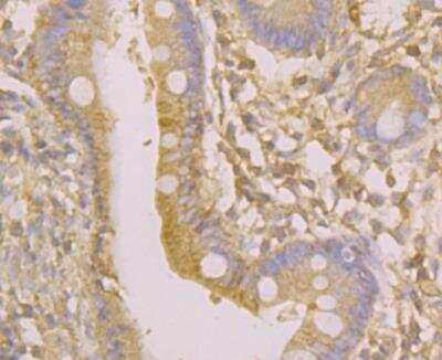 Immunohistochemistry: Osteoprotegerin/TNFRSF11B Antibody (9C2) [NBP2-76904] - Immunohistochemical analysis of paraffin-embedded human small intestine tissue using anti-Osteoprotegerin antibody. Counter stained with hematoxylin.