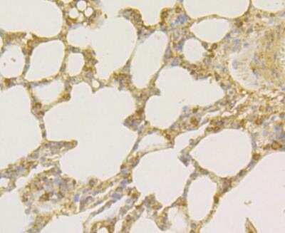 Immunohistochemistry: Osteoprotegerin/TNFRSF11B Antibody (9C2) [NBP2-76904] - Immunohistochemical analysis of paraffin-embedded rat lung tissue using anti-Osteoprotegerin antibody. Counter stained with hematoxylin.