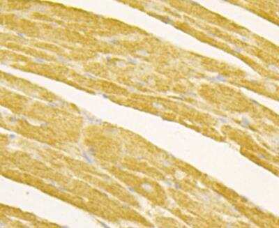 Immunohistochemistry: Osteoprotegerin/TNFRSF11B Antibody (9C2) [NBP2-76904] - Immunohistochemical analysis of paraffin-embedded mouse heart tissue using anti-Osteoprotegerin antibody. Counter stained with hematoxylin.