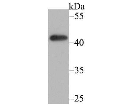 Western Blot: Osteoprotegerin/TNFRSF11B Antibody (9C2) [NBP2-76904] - Western blot analysis of Osteoprotegerin on K562 cell lysate using anti-Osteoprotegerin antibody at 1/500 dilution.