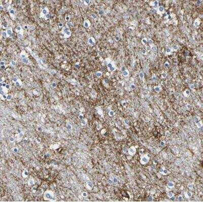 Immunohistochemistry-Paraffin: Otoferlin Antibody [NBP1-85233] - Staining of human caudate shows strong positivity in processes.