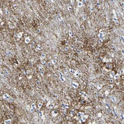 Immunohistochemistry-Paraffin: Otoferlin Antibody [NBP1-85233] - Staining of human caudate nucleus shows moderate membranous positivity in neuropil.