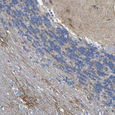 Immunohistochemistry-Paraffin: Otoferlin Antibody [NBP1-85233] - Staining of human cerebellum shows weak positivity in neuropil.