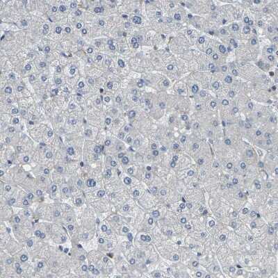 Immunohistochemistry-Paraffin: Otoferlin Antibody [NBP1-85233] - Staining of human liver shows no positivity in hepatocytes as expected.