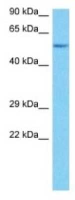 Western Blot: Otolin-1 Antibody [NBP3-10193] - Western blot analysis of Otolin-1 in Mouse Heart lysates. Antibody dilution at 1ug/ml