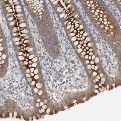 Immunohistochemistry-Paraffin: Otoraplin/OTOR Antibody [NBP1-83912] - Staining of human appendix shows distinct cytoplasmic and membranous positivity in glandular cells.