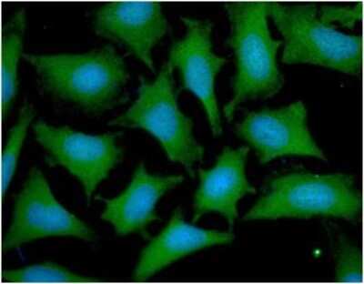 Immunocytochemistry/Immunofluorescence: Otubain-1 Antibody (17E10) [NBP2-59389] - Analysis of OTUB1 in HeLa cells line, stained with DAPI (Blue) for nucleus staining and monoclonal anti-human OTUB1 antibody (1:100) with goat anti-mouse IgG-Alexa fluor 488 conjugate (Green).