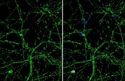 Immunocytochemistry/Immunofluorescence: Otubain-1 Antibody (GT611) [NBP3-13627] - Otubain-1 antibody [GT611] detects Otubain-1 protein by immunofluorescent analysis. Sample: DIV9 rat E18 primary cortical neuron cells were fixed in 4% paraformaldehyde at RT for 15 min. Green: Otubain-1 stained by Otubain-1 antibody [GT611] (NBP3-13627) diluted at 1:500. Red: NeuN, stained by NeuN antibody diluted at 1:1000. Blue: Fluoroshield with DAPI.