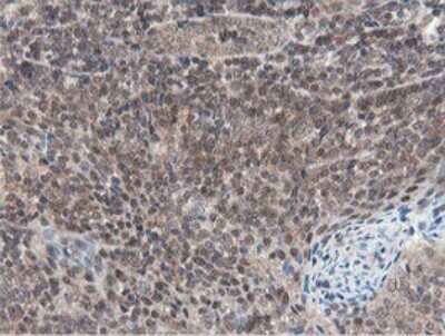 Immunohistochemistry: Otubain-1 Antibody (OTI5B8) [NBP2-45879] - Analysis of Human tonsil tissue within the normal limits using OTUB1 mouse monoclonal antibody.