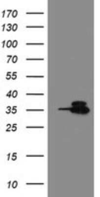 Western Blot: Otubain-1 Antibody (OTI5B8) [NBP2-45879] - Analysis of HEK293T cells were transfected with the pCMV6-ENTRY control (Left lane) or pCMV6-ENTRY Otubain-1.
