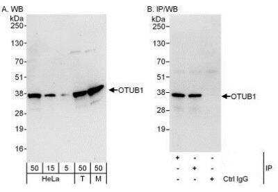 Western Blot: Otubain-1 Antibody [NBP1-49934] - Detection of Human and Mouse OTUB1 by Western Blot (h&m) and Immunoprecipitation (h).  Samples: Whole cell lysate from HeLa (5, 15 and 50 mcg for WB; 1 mg for IP, 20% of IP loaded), 293T (T; 50 mcg) and mouse NIH3T3 (M; 50 mcg) cells.  Antibodies: Affinity purified rabbit anti-OTUB1 antibody used for WB at 0.04 mcg/ml (A) and 0.4 mcg/ml (B) and used for IP at 3 mcg/mg lysate.  OTUB1 was also immunoprecipitated by rabbit anti-OTUB1 antibody which recognizes a downstream epitope.  For blotting immunoprecipitated OTUB1 was used.   Detection: Chemiluminescence with exposure times of 30 seconds (A) and 10 seconds (B).