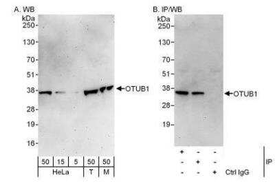 Western Blot: Otubain-1 Antibody [NBP1-49935] - OTUB1 Antibody [NBP1-49935] - Detection of Human and Mouse OTUB1 by Western Blot (h&m) and Immunoprecipitation (h). Samples:  Whole cell lysate from HeLa (5, 15 and 50 mcg for WB; 1 mg for IP, 20% of IP loaded), 293T (T; 50 mcg) and mouse NIH3T3 (M; 50 mcg) cells. Antibodies: Affinity purified rabbit anti-OTUB1 antibody used for WB at 0.04 mcg/ml (A) and 0.4 mcg/ml (B) and used for IP at 3 mcg/mg lysate.  OTUB1 was also immunoprecipitated by rabbit anti-OTUB1 antibody, which recognizes an upstream epitope.  For blotting immunoprecipitated OTUB1 was used.   Detection: Chemiluminescence with exposure times of 3 minutes (A) and 30 seconds (B).