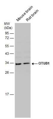 Western Blot: Otubain-1 Antibody [NBP3-13214] - Various tissue extracts (50 ug) were separated by 12% SDS-PAGE, and the membrane was blotted with Otubain-1 antibody (NBP3-13214) diluted at 1:1000.