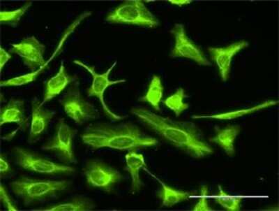 Immunocytochemistry/Immunofluorescence: Otubain-2 Antibody [H00078990-D01P] - Analysis of antibody to OTUB2 on HeLa cell. Antibody concentration 10 ug/ml.