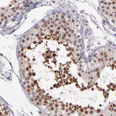 Immunohistochemistry-Paraffin: Otubain-2 Antibody [NBP1-88410] - Staining of human testis shows distinct nuclear positivity in seminiferus duct cells.