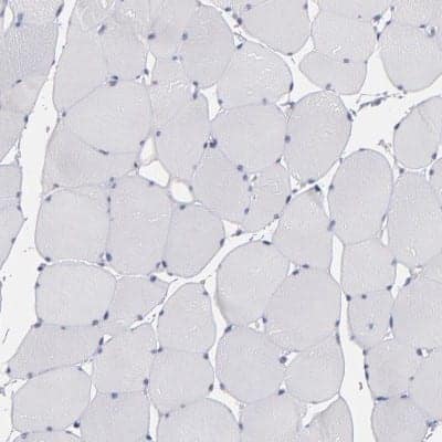 Immunohistochemistry-Paraffin Otubain-2 Antibody - BSA Free