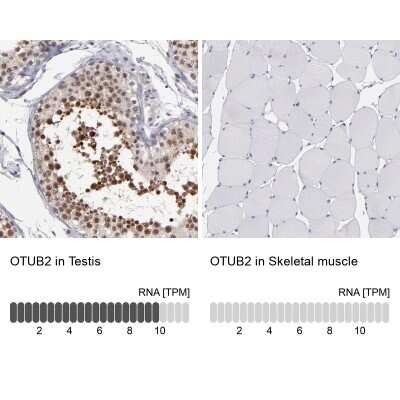 Immunohistochemistry-Paraffin Otubain-2 Antibody - BSA Free