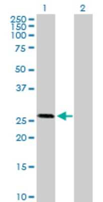 Western Blot: Otubain-2 Antibody [H00078990-B01P] - Analysis of OTUB2 expression in transfected 293T cell line by OTUB2 polyclonal antibody.  Lane 1: OTUB2 transfected lysate(25.74 KDa). Lane 2: Non-transfected lysate.
