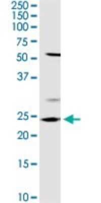 Western Blot: Otubain-2 Antibody [H00078990-D01P] - Analysis of OTUB2 expression in IMR-32.
