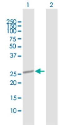 Western Blot: Otubain-2 Antibody [H00078990-D01P] - Analysis of OTUB2 expression in transfected 293T cell line by OTUB2 polyclonal antibody.Lane 1: OTUB2 transfected lysate(27.20 KDa).Lane 2: Non-transfected lysate.