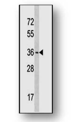 Western Blot: Otx1 Antibody [NBP2-12545]