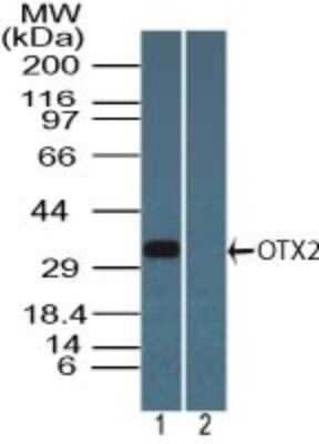 Western Blot: Otx2 Antibody [NBP2-24652] - Analysis of OTX2 in Y79 cell lysate in the 1) absence and 2) presence of immunizing peptide using this antibody. Goat anti-rabbit Ig HRP secondary antibody and PicoTect ECL substrate solution were used for this test.