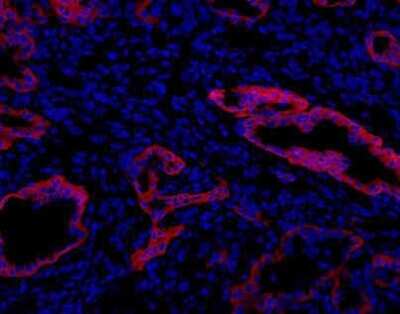 Immunohistochemistry: Oval Cell Marker Antibody (MIC1-1C3) - Azide and BSA Free [NBP2-80896] - Analysis of DDC treated mouse liver. Image from the standard format of this antibody.