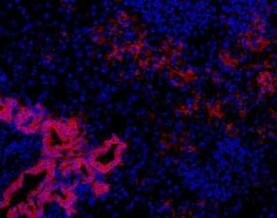 Immunohistochemistry-Frozen: Oval Cell Marker Antibody (OC2-2F3) [NBP1-18964] - Immunohistochemical analysis of DDC treated mouse liver using NBP1-18964.