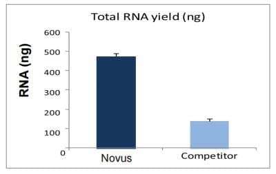 Overall Exosome Capture and RNA Extraction (Biofluids, Cell Media) Kit [NBP2-49784] - Comparasion of total RNA yield (Nanodrop quantification) for exosomal RNA extraction kits from Novus Biologicals' and a competitor