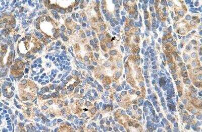 Immunohistochemistry-Paraffin: P-Cadherin Antibody [NBP1-59222] - Human Kidney