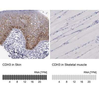 Immunohistochemistry-Paraffin: P-Cadherin Antibody [NBP1-85707] - Analysis in human skin and skeletal muscle tissues. Corresponding CDH3 RNA-seq data are presented for the same tissues.