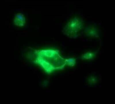 Immunocytochemistry/Immunofluorescence: P-Cadherin Antibody (OTI2D5) - Azide and BSA Free [NBP2-73267] - Analysis of COS7 cells transiently transfected by pCMV6-ENTRY P-Cadherin.