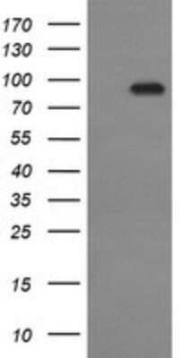 Western Blot: P-Cadherin Antibody (OTI2D5) - Azide and BSA Free [NBP2-73267] - Analysis of HEK293T cells were transfected with the pCMV6-ENTRY control (Left lane) or pCMV6-ENTRY P-Cadherin.