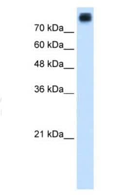 Western Blot: P-Cadherin Antibody [NBP1-59222] - Suggested Anti-CDH3 Antibody Titration: 1.25ug/ml Positive Control: HepG2 cell lysate