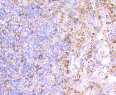 Immunohistochemistry-Paraffin: P-Selectin/CD62P Antibody (JM10-95) [NBP2-67080] - Analysis of paraffin-embedded human spleen tissue using anti-CD62P antibody. Counter stained with hematoxylin.